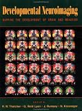 Developmental Neuroimaging: Mapping the Development of Brain and Behavior