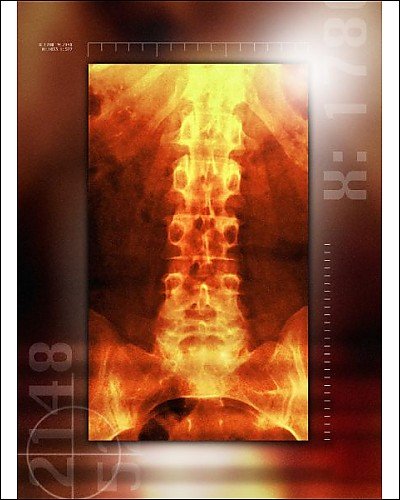 Photographic Print of Healthy lower back, X-ray from Science Photo Library