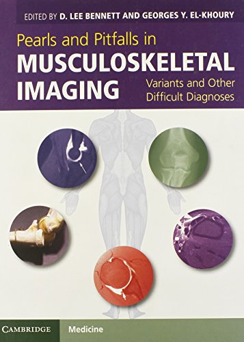 pearls and pitfalls in musculoskeletal imaging variants and other difficult diagnoses