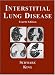 Interstitial Lung Disease