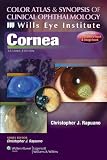 Cornea