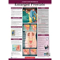 Diseases Explained: Enlarged Prostate Wall Chart
