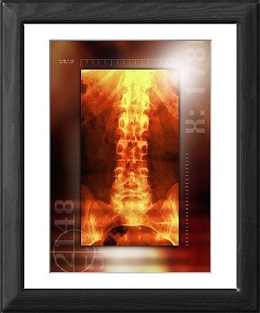 Framed Print of Healthy lower back, X-ray from Science Photo Library