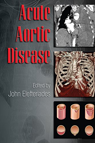 Acute Aortic Disease (Fundamental and Clinical Cardiology)