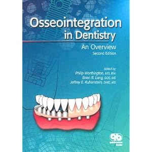 Click here to buy Osseointegration in Dentistry: An Overview by Philip Worthington, Brien R. Lang, and Jeffrey E. Rubenstein.