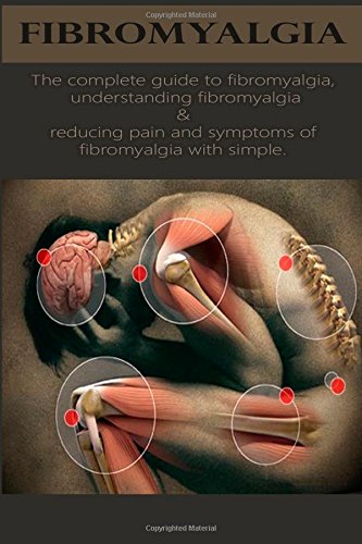 fibromyalgia the complete guide to fibromyalgia understanding fibromyalgia and reducing pain and symptoms of