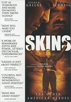 Skins