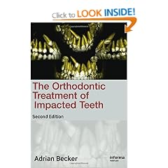 Orthodontic Treatment of Impacted Teeth