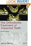 Orthodontic Treatment of Impacted Teeth