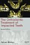 Orthodontic Treatment of Impacted Teeth