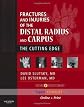 Fractures and Injuries of the Distal Radius and Carpus: The Cutting Edge - Expert Consult: Online and Print (Expert Consult Title: Online + Print)