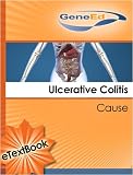 Ulcerative Colitis: Cause