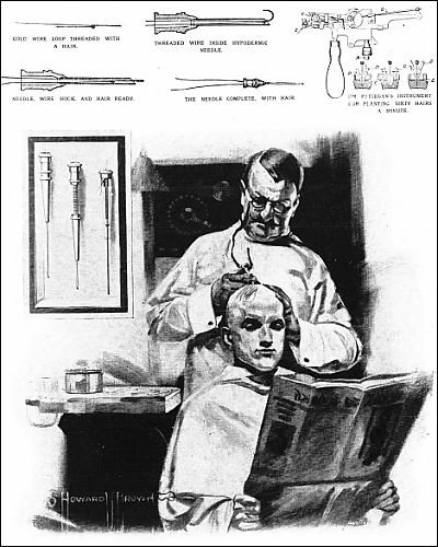 Photographic Prints of Hair transplant from Mary Evans