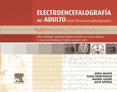 Electroencefalografía del adulto: Atlas bilingüe español-inglés basado en casos clínicos (Spanish Edition)