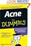 Acne For Dummies
