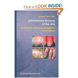 Autoimmune Diseases of the Skin