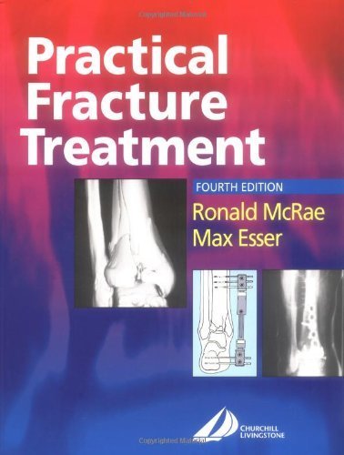 Practical Fracture Treatment, 4th Edition by Ronald McRae (2002-07-24)