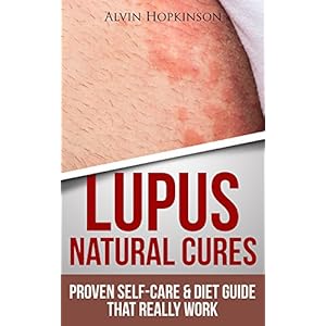 Lupus Natural Cures: Proven Self-Care Guide & Diet That Really Work (Top Rated 30-min Series)