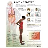Risks of Obesity Anatomical Chart