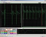Pulse Metabolic Analysis Seystem