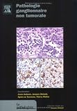 Pathologie ganglionaire non tumorale