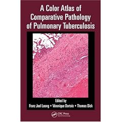 A Color Atlas of Comparative Pathology of Pulmonary Tuberculosis by Franz Joel Leong, Veronique Dartois and Thomas Dick
