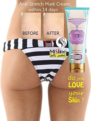 Mistine lecer cream bikini armpit elbow anti stretch ma…
