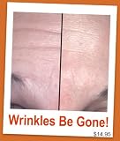Wrinkles Be Gone 51L5uz0yfLL. SL160 Wrinkles Be Gone