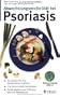 Abwechslungsreiche Di�t bei Psoriasis: So meiden Sie pers�nliche Ausl�ser. 100 Seiten k�stliche Rezepte. Guten Appetit vom Fr�hst�ck bis zum Abendessen