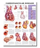 Cardiovascular Disease Anatomical Chart
