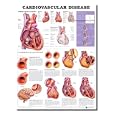 Cardiovascular Disease Anatomical Chart by Anatomical Chart Company
