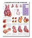 Cardiovascular Disease Anatomical Chart