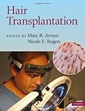 Hair transplantation