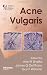 Acne Vulgaris