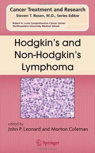 lymphoma treatment