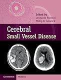 Cerebral small vessel disease