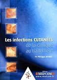 Les infections cutan�es : De la clinique au traitement