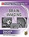 Radiology Case Review Series: Brain Imaging