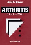 Arthritis: in Black and White