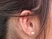 Tinnitus: Causes and Treatments en Libros del nombre: 51LdiB8WM%2BL._SL75_