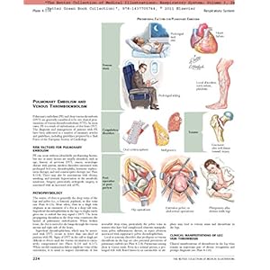 The Netter Collection of Medical Illustrations: Respiratory System: Volume 3, 2e (Netter Green Book Collection)