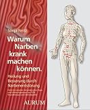 Produkt-Bild: Warum Narben krank machen k&ouml;nnen. Heilung und Besserung durch Narbenentst&ouml;rung