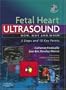 Fetal Heart Ultrasound: How, Why and When, 1e