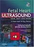 Fetal Heart Ultrasound: How, Why and When