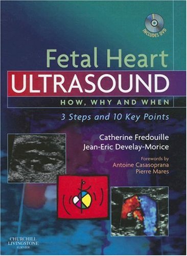 fetal heart ultrasound how why and when 1e