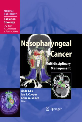 Nasopharyngeal Cancer: Multidisciplinary Management (Medical Radiology)