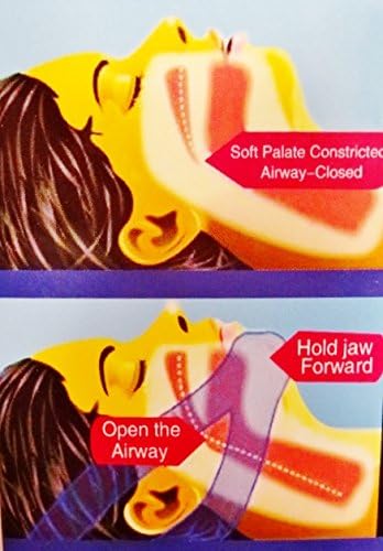 Stop Snoring Now with our Professional Stop Snoring Solution Jaw Strap. Comfort Fit with Innovative Adjustable Velcro to Fit any Size Head!