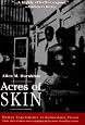 Acres of Skin: Human Experiments at Holmesburg Prison