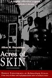 Acres of Skin