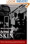 Acres of Skin: Human Experiments at Holmesburg Prison